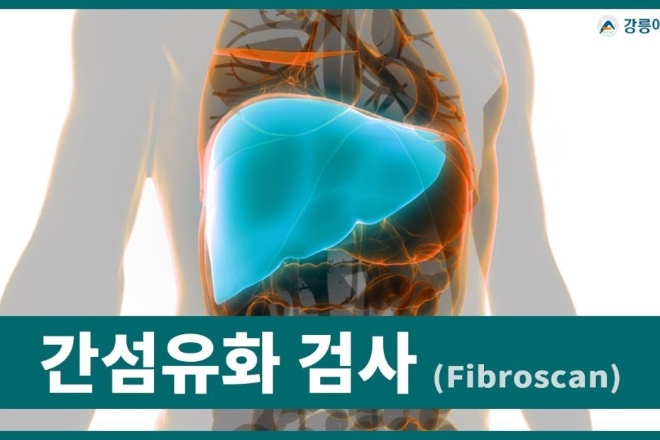 간섬유화 검사 (Fibroscan)