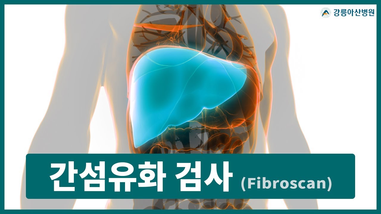 간섬유화 검사 (Fibroscan)